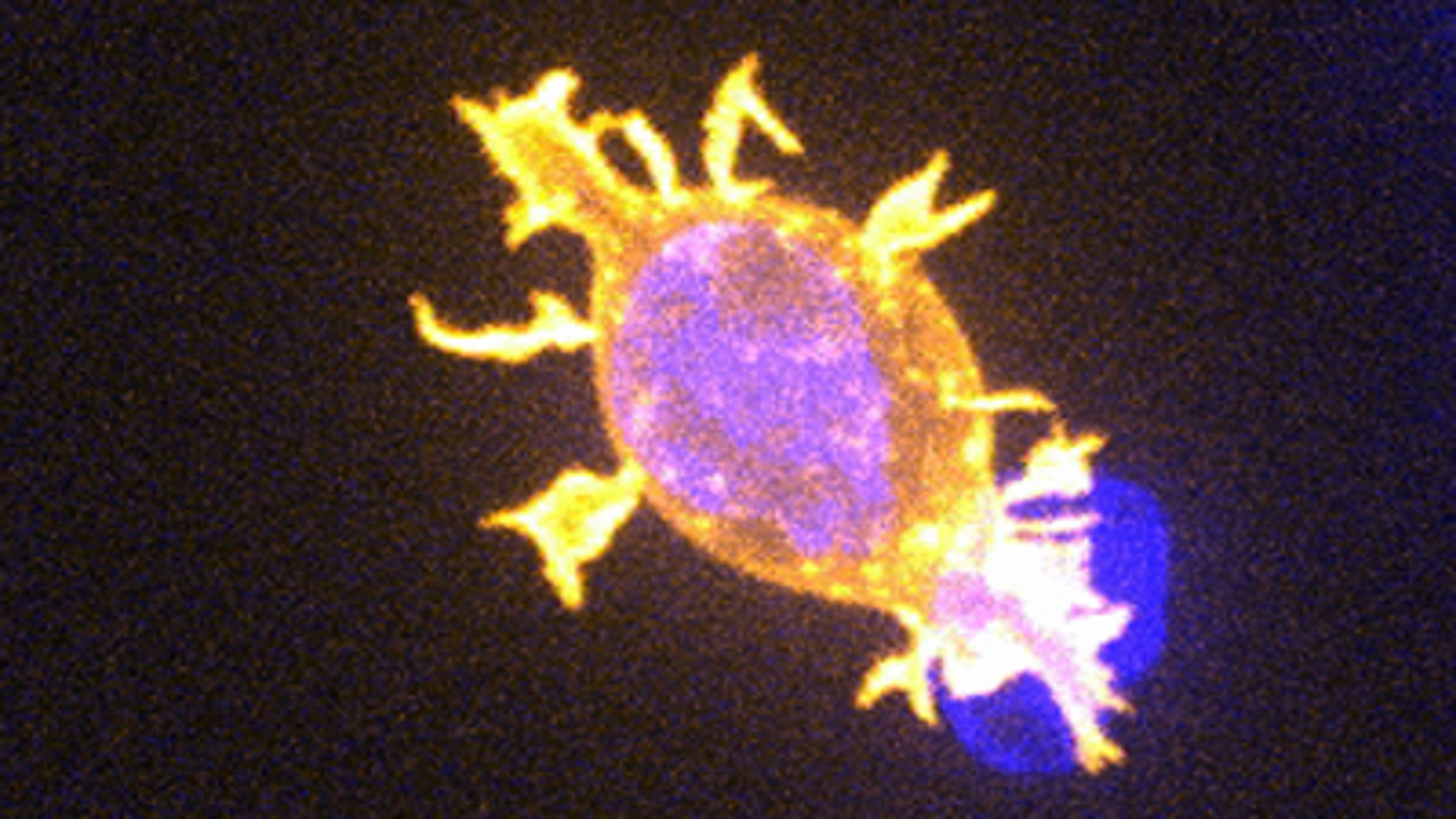 Killer T cells attacking cancer